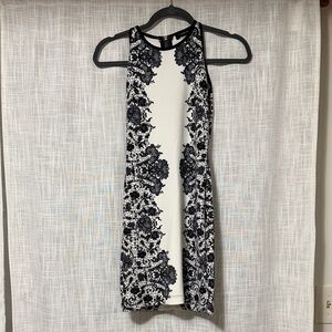Elegant Black and White Lace Dress